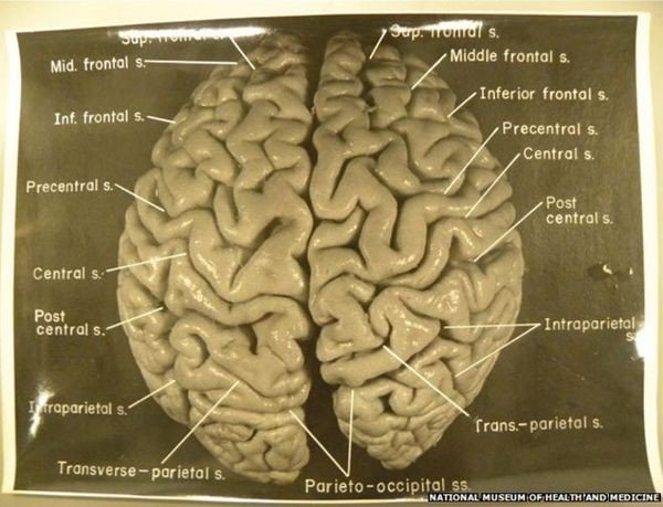 Einstein's Brain from BBC News